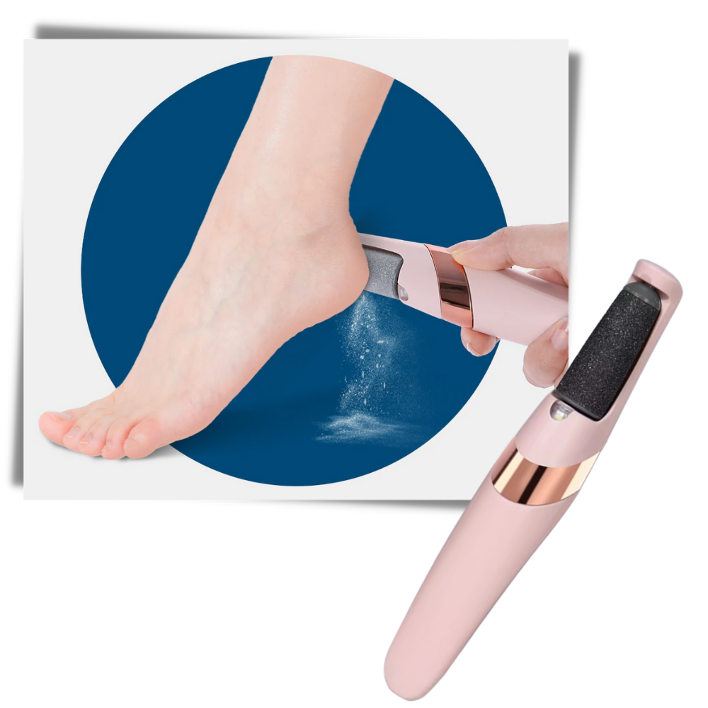 Rechargeable Electric Callus Remover - Ozerty