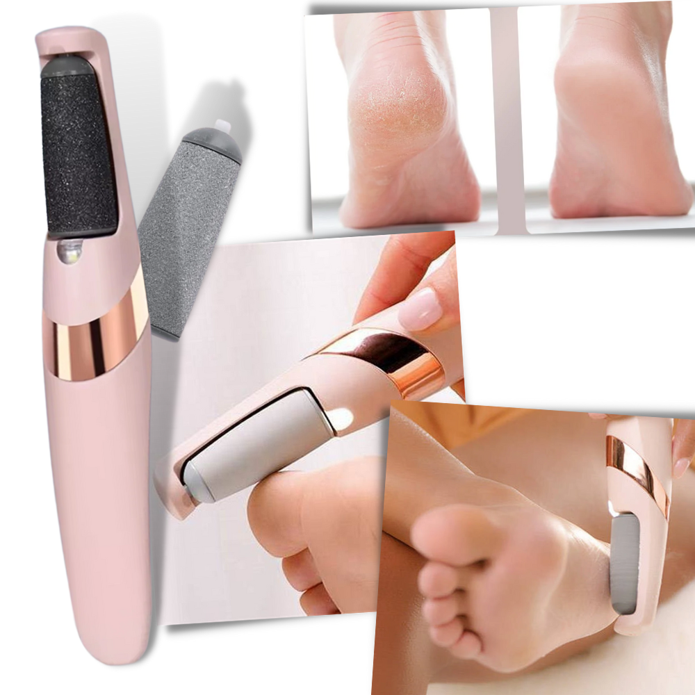 Rechargeable Electric Callus Remover - Ozerty