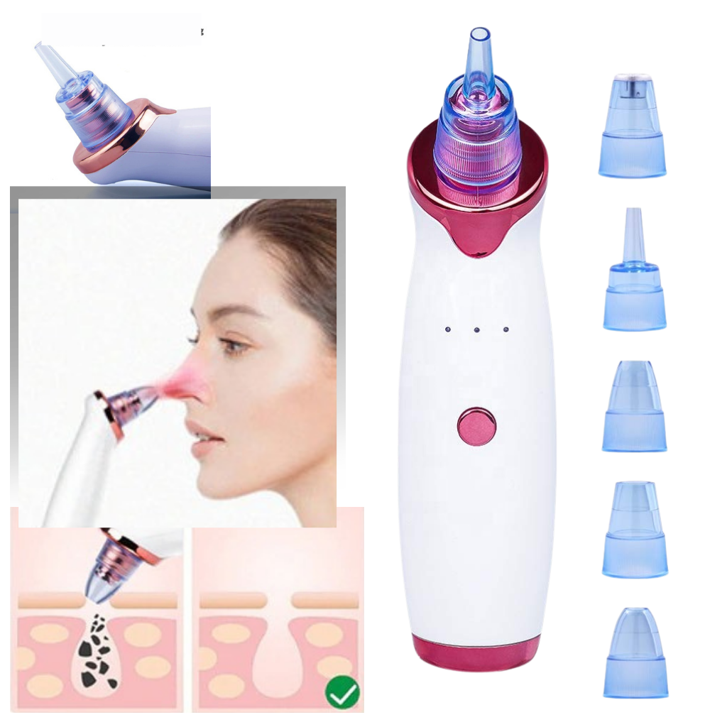 Blackhead Pore Remover Vacuum - Ozerty