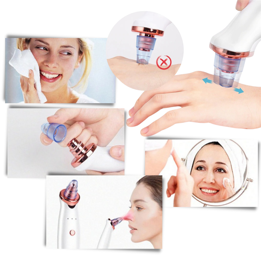 Blackhead Pore Remover Vacuum - Ozerty