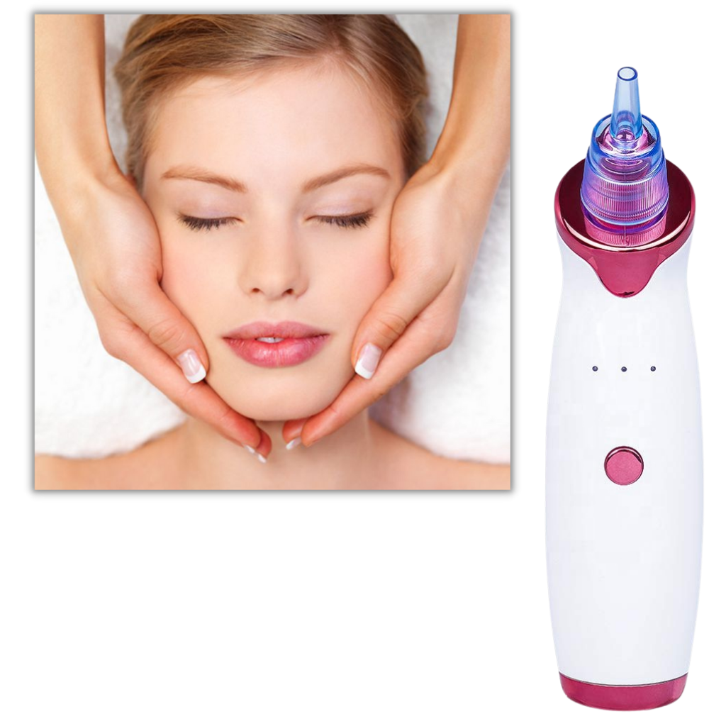 Blackhead Pore Remover Vacuum - Ozerty