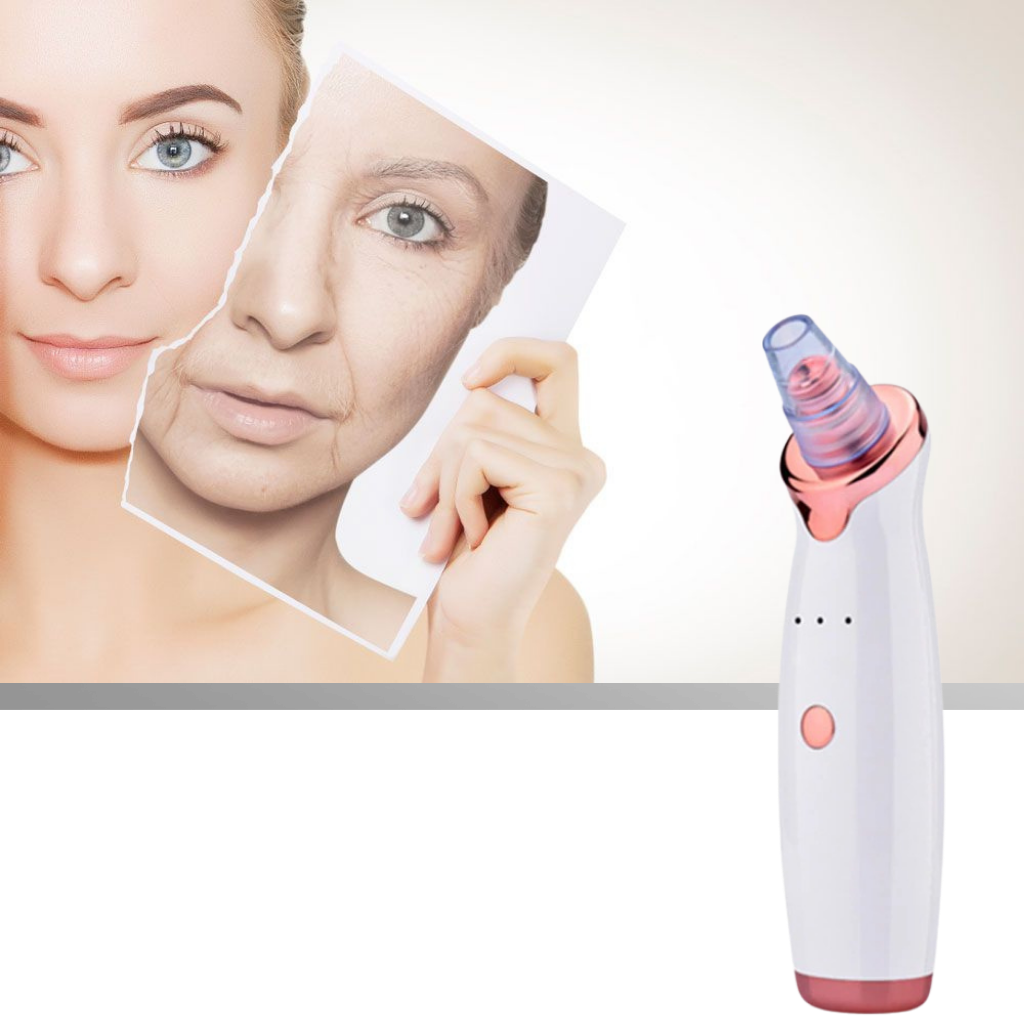 Blackhead Pore Remover Vacuum - Ozerty