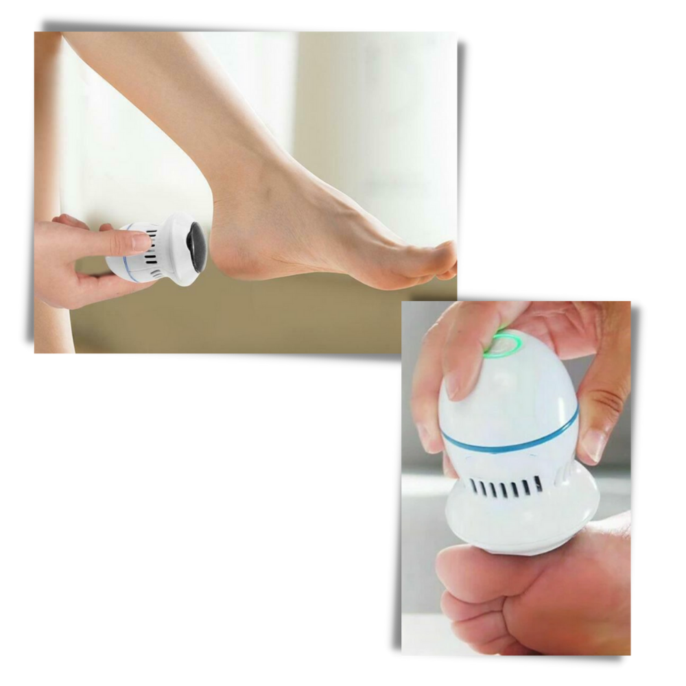 Electric Callus Remover - Ozerty