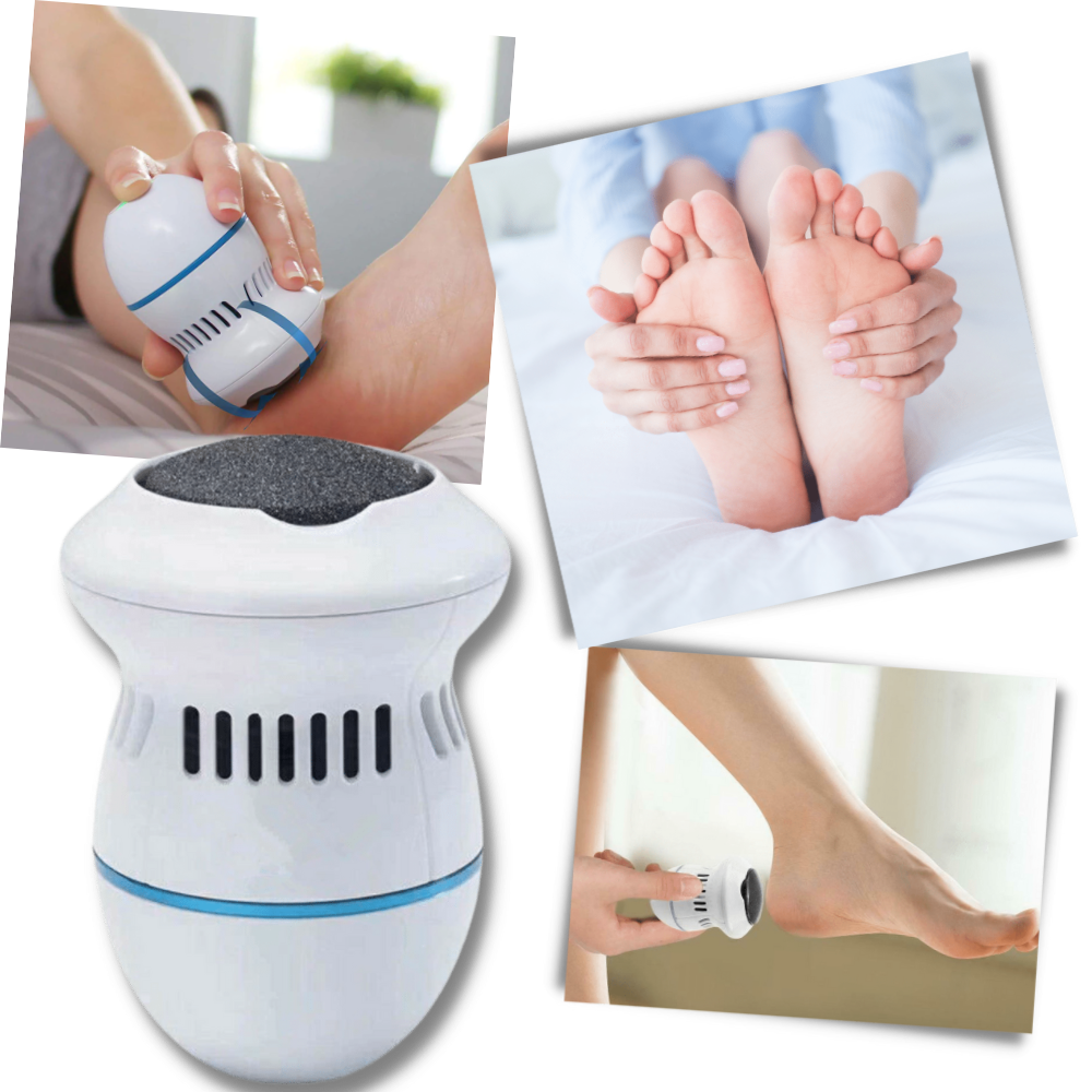 Electric Callus Remover - Ozerty