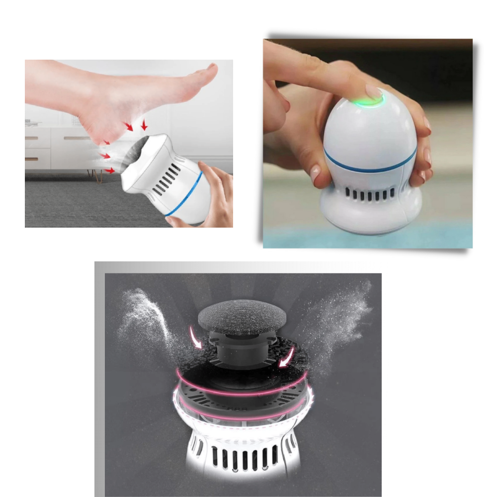 Electric Callus Remover - Ozerty