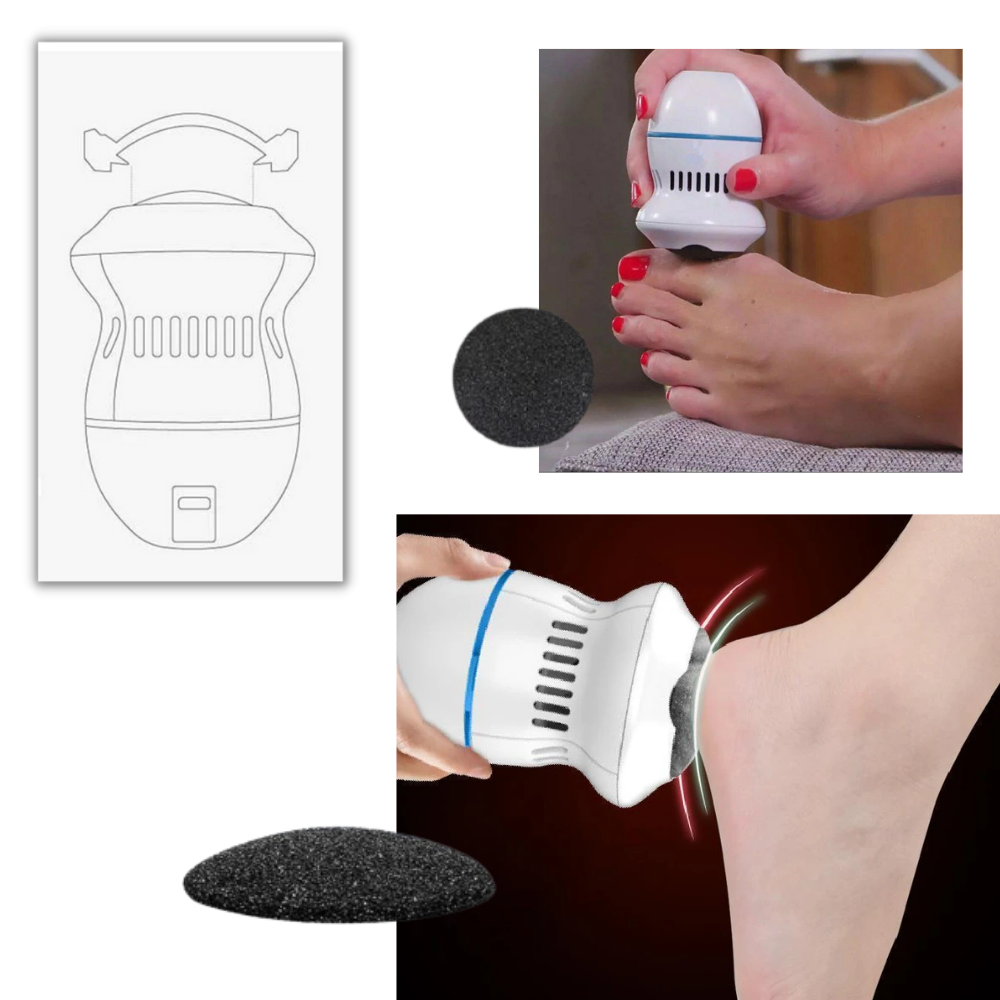 Electric Callus Remover - Ozerty