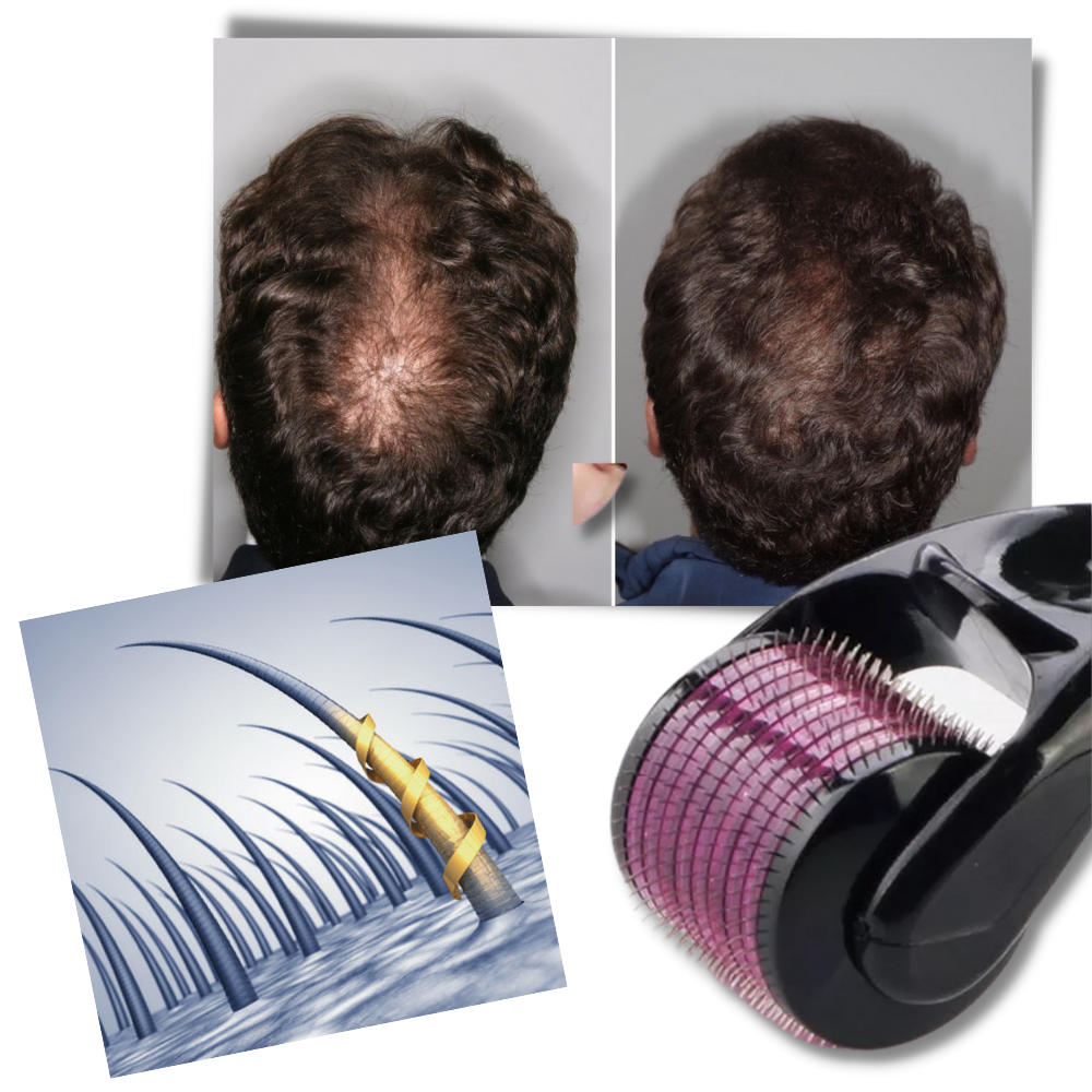 Derma roller for hair and beard growth - Ozerty