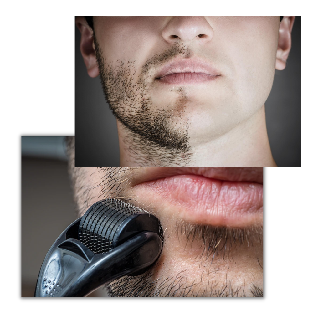 Derma roller for hair and beard growth - Ozerty