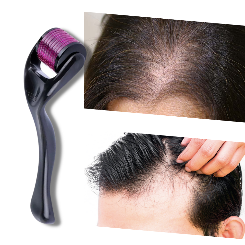 Derma roller for hair and beard growth - Ozerty