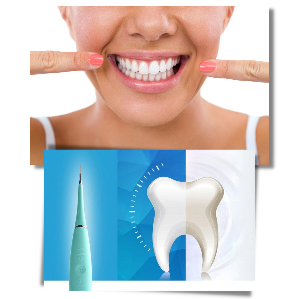 Deep Cleaning Tooth Tartar Machine - Ozerty