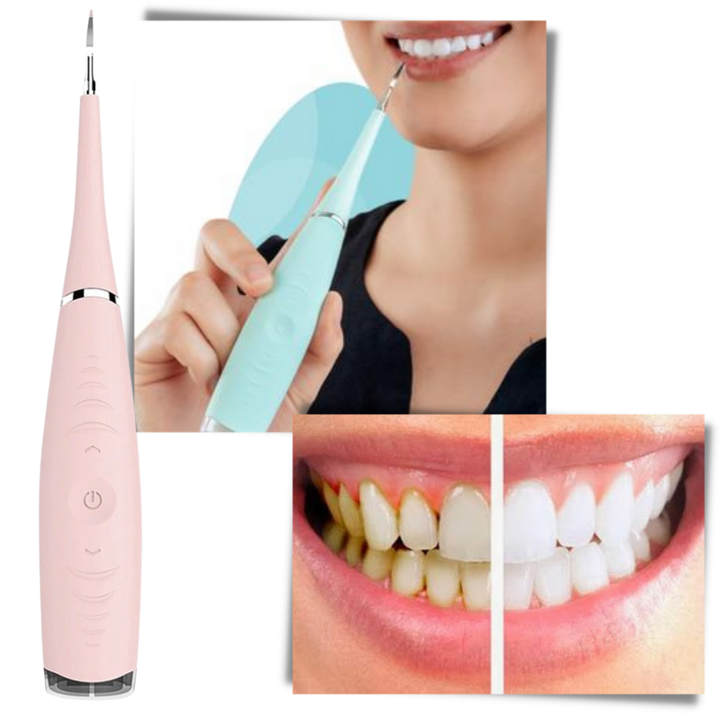 Deep Cleaning Tooth Tartar Machine - Ozerty