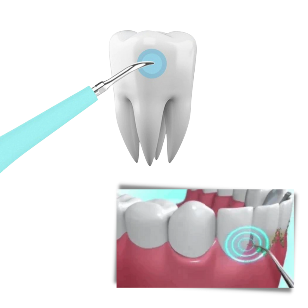 Deep Cleaning Tooth Tartar Machine - Ozerty
