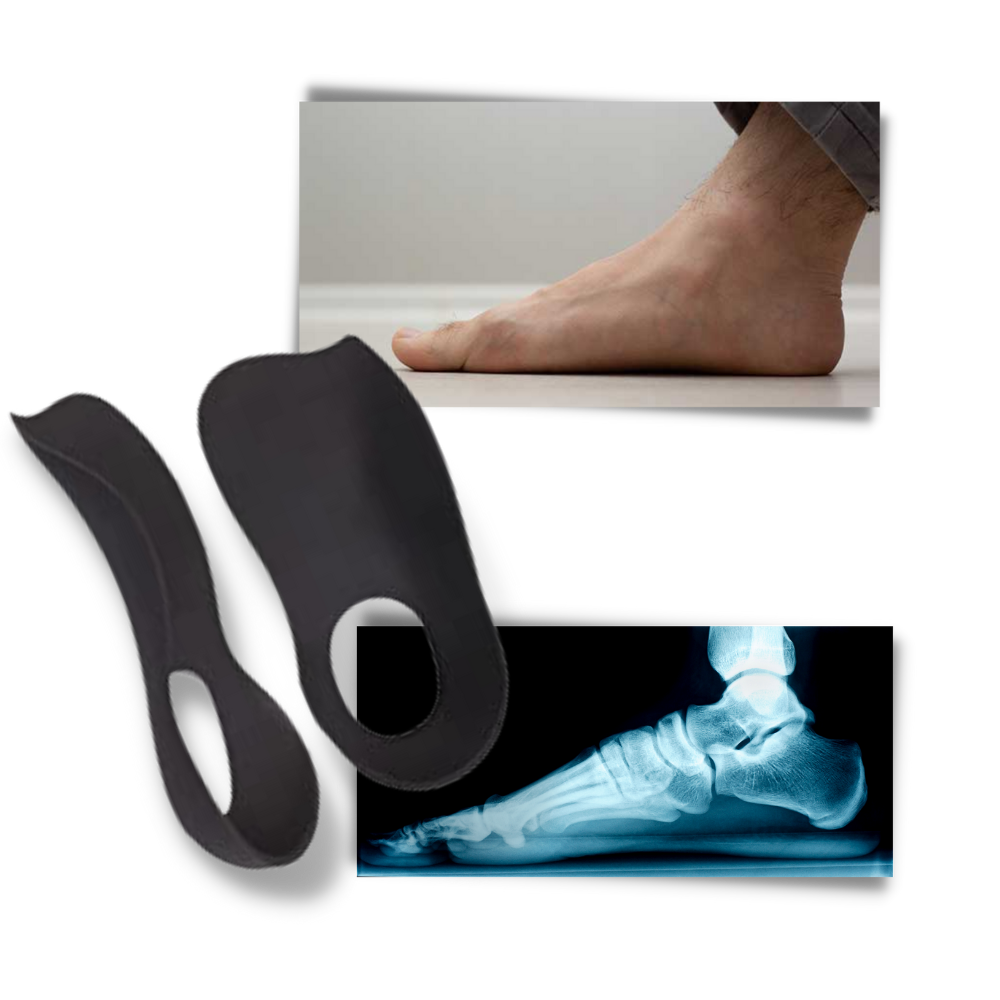 Orthopedic insoles for flat feet - Ozerty