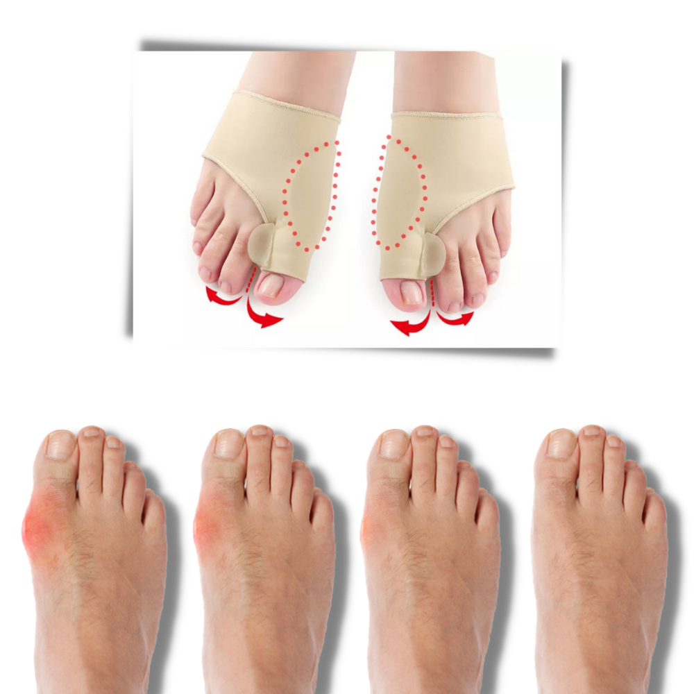 Gel bunion corrector - Ozerty