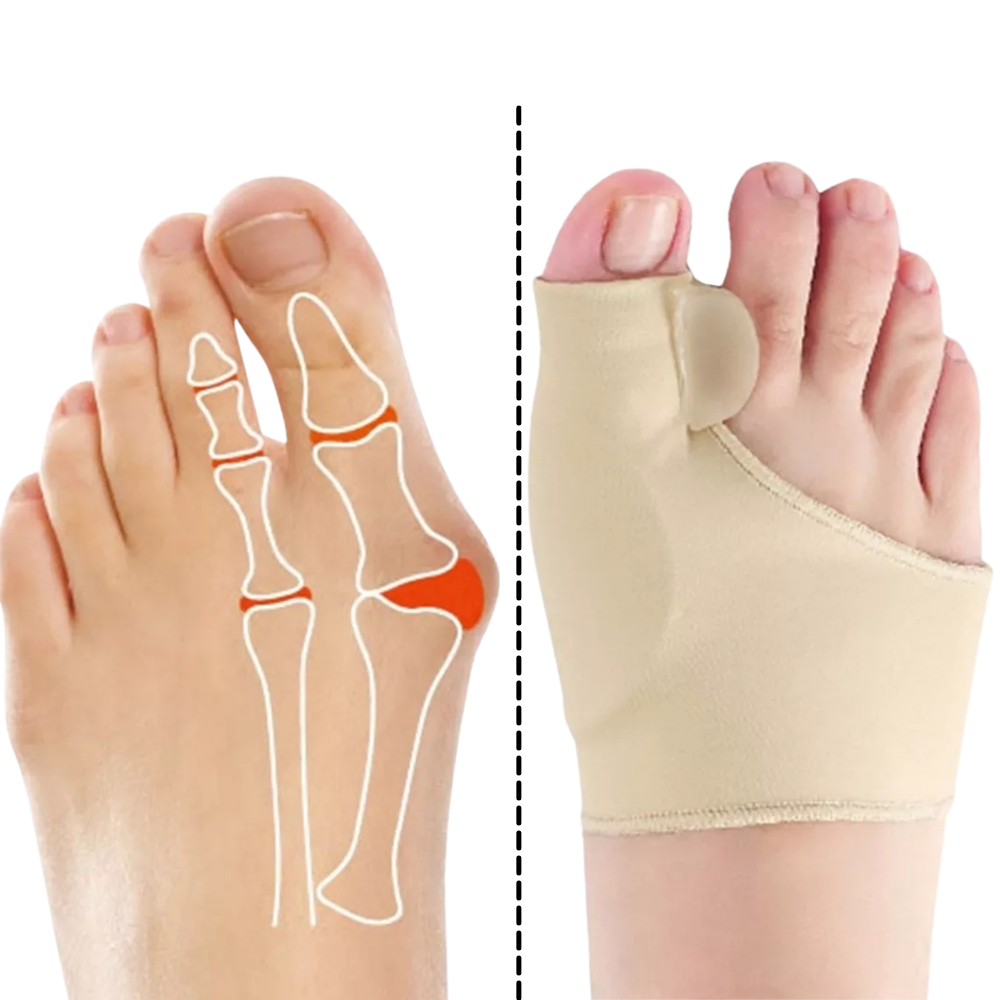 Gel bunion corrector - Ozerty