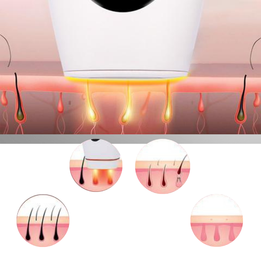 IPL Laser Hair Remover Handset - Ozerty
