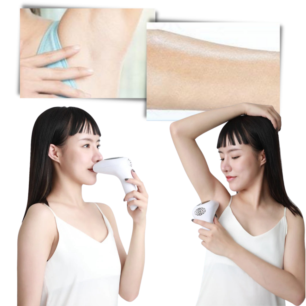 IPL Laser Hair Remover Handset - Ozerty