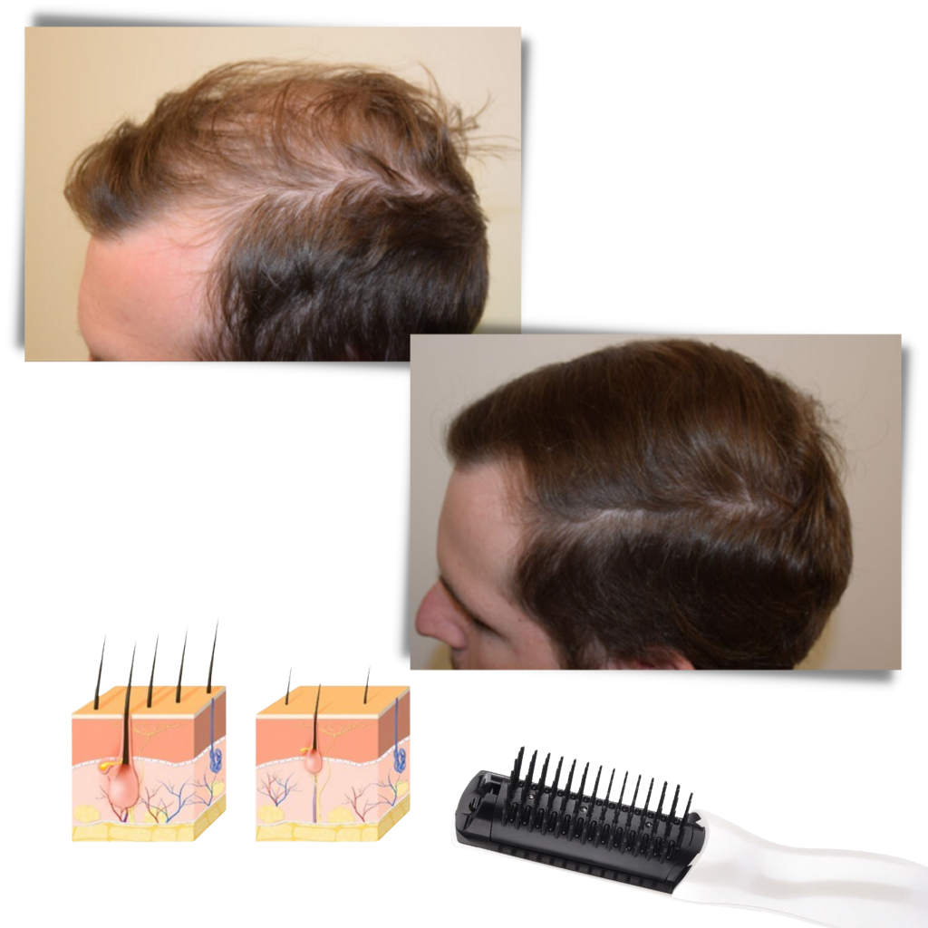 Infrared Laser Comb - Ozerty