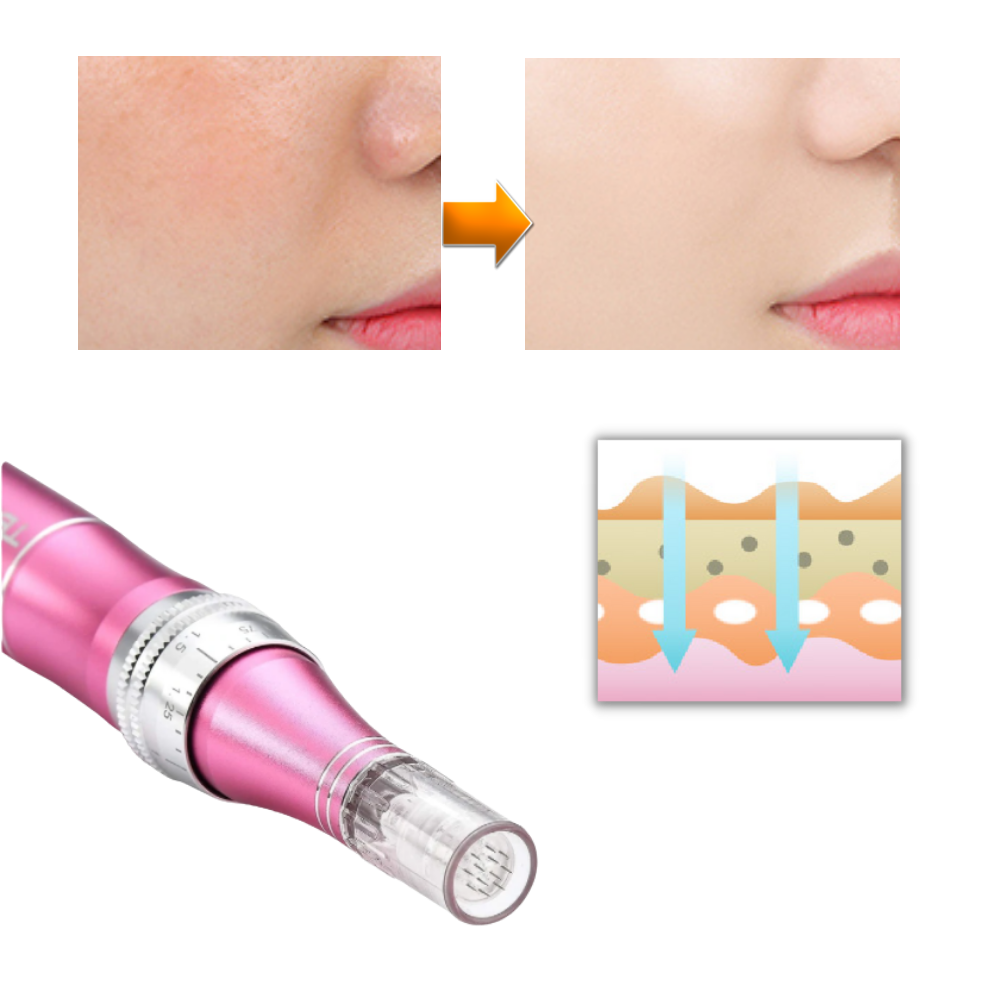 Dermal Microneedling Pen - Ozerty