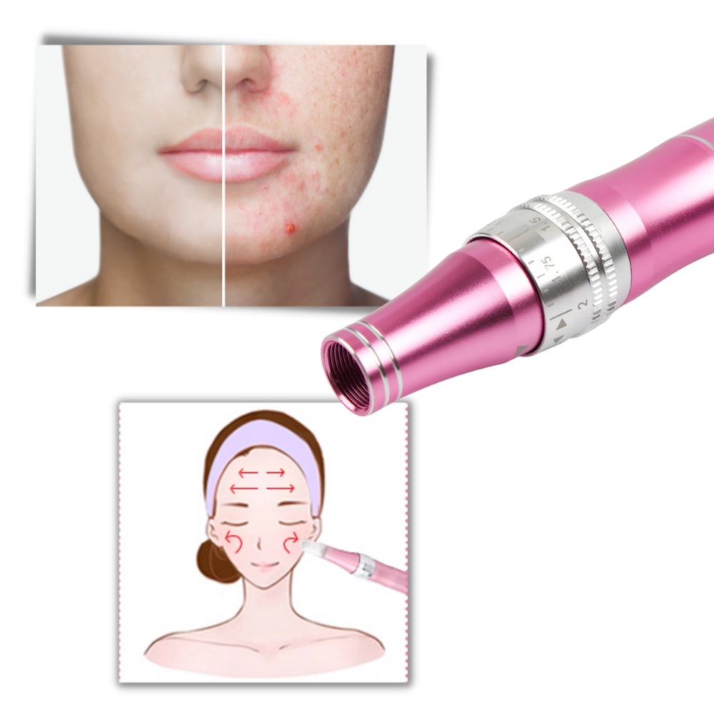 Dermal Microneedling Pen - Ozerty