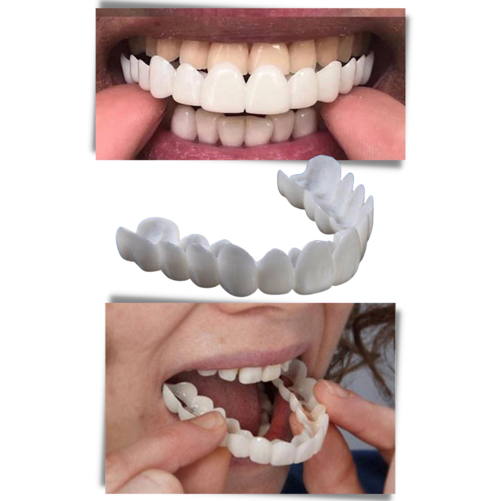 Perfect smile dental coverage - comfortable veneers - Ozerty