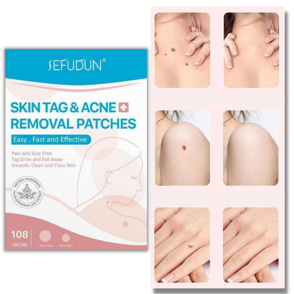 Skin tag removal treatment patch - Ozerty