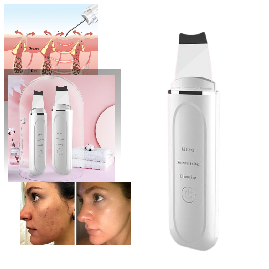 Ultrasonic deep cleansing facial scrubber - Ozerty